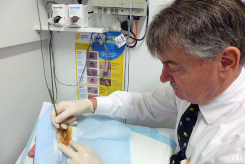 port_macquarie_skin_cancer_clinic_dr_clarke